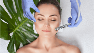 Microdermabrasion
