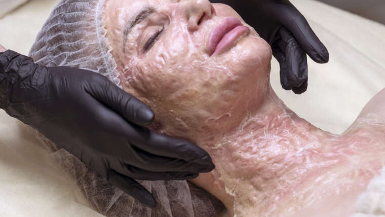 Enzyme Facials