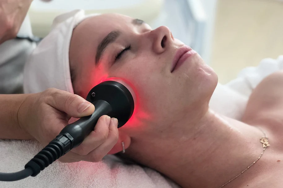 Microdermabrasion+ Radiofrequency